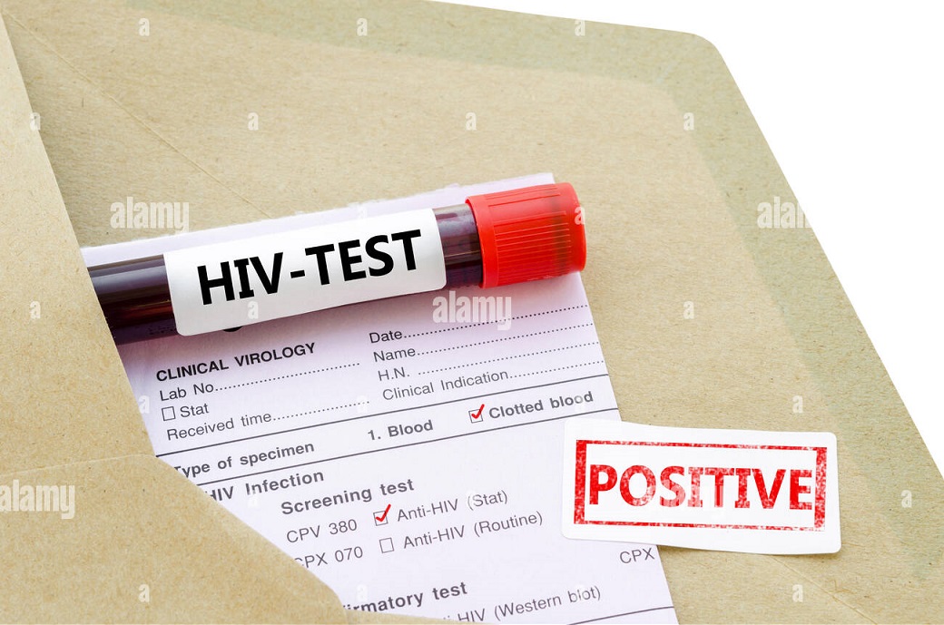 تشخیص آزمایشگاهی HIV